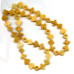 214-1291 Yellow Jade <br>13-17mm Poker Suits